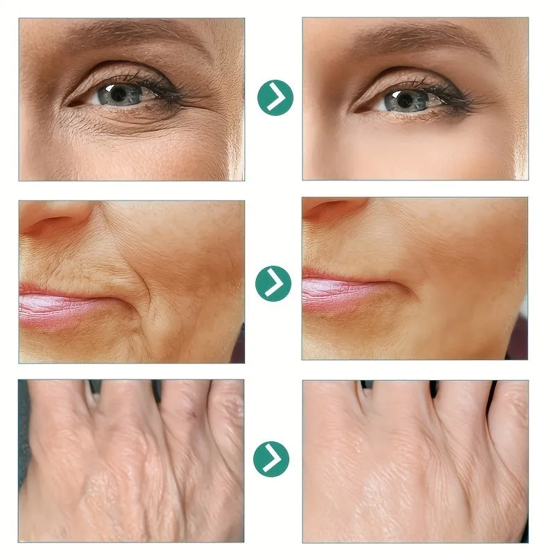 Instant Wrinkle Cream Moisturizes Tightens and Rejuvenates Skin