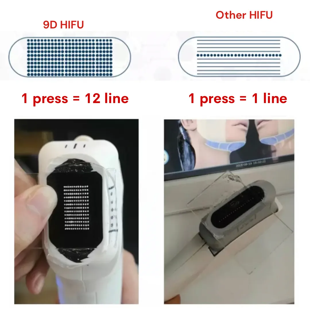 Replacement Cartridge for 9D Face Lifting HIFU Machine